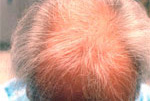 Male Hair example 2 before